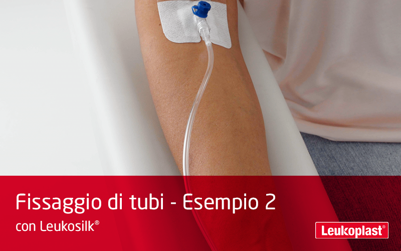 Questo video dimostra come i tubi sono fissati utilizzando un cerotto su rocchetto per pelli delicate: un operatore sanitario sta fissando un tubo sull'avambraccio di un paziente con Leukosilk Questo video dimostra come i tubi sono fissati utilizzando un cerotto su rocchetto per pelli delicate: un operatore sanitario sta fissando un tubo sull'avambraccio di un paziente con Leukosilk